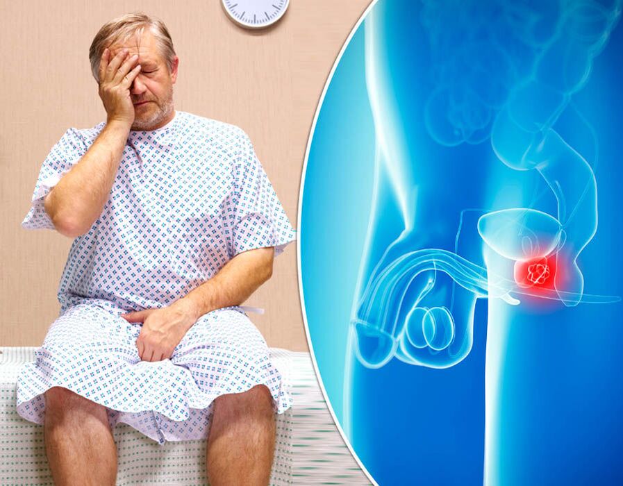Un home con prostatite é diagnosticado da enfermidade